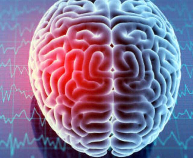 Headache area on brain X-ray, 3D illustration.